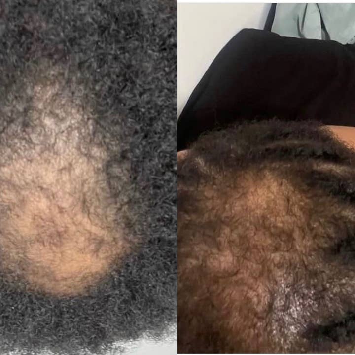 Unique Organics Haircare - Wholesale Hair Oil - Batana Miracle Hair Loss Oil From Honduras