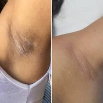 Nuances Exotiques - Wholesale Facial Exfoliant/Scrub - Anti-Imperfection Turmeric Scrub 250ml3