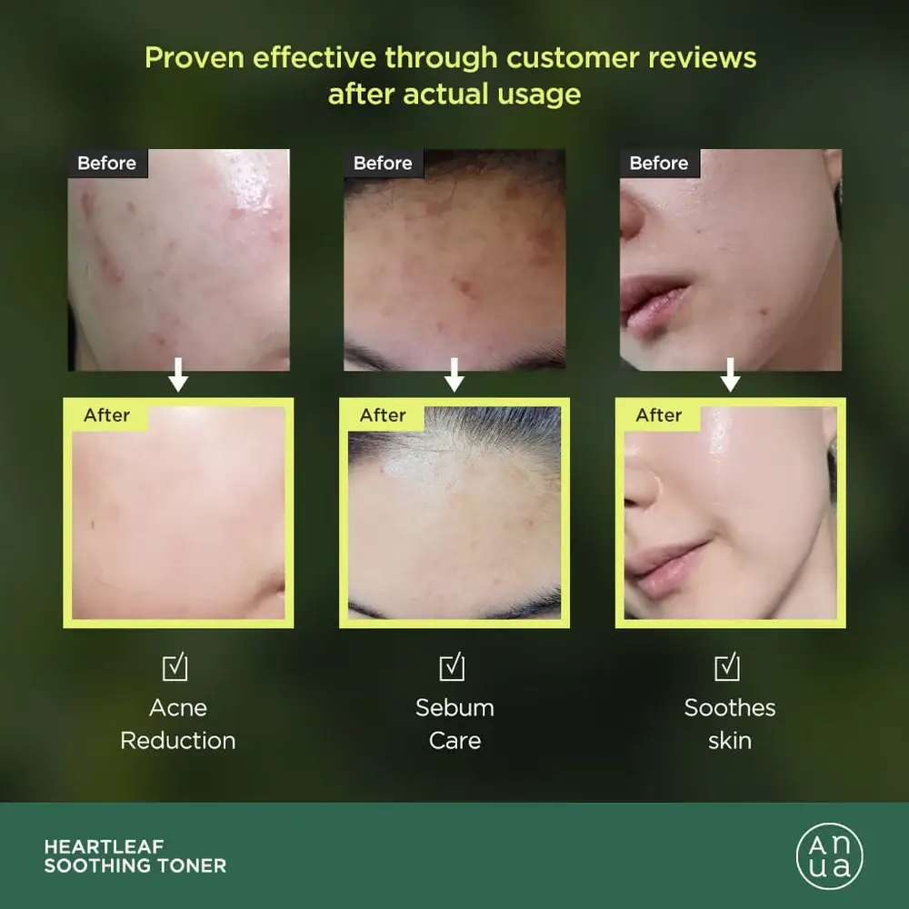 Kosmic - Kbeauty Skincare - Wholesale Facial Toner - [ANUA] HEARTLEAF 77% SOOTHING TONER 250ML4