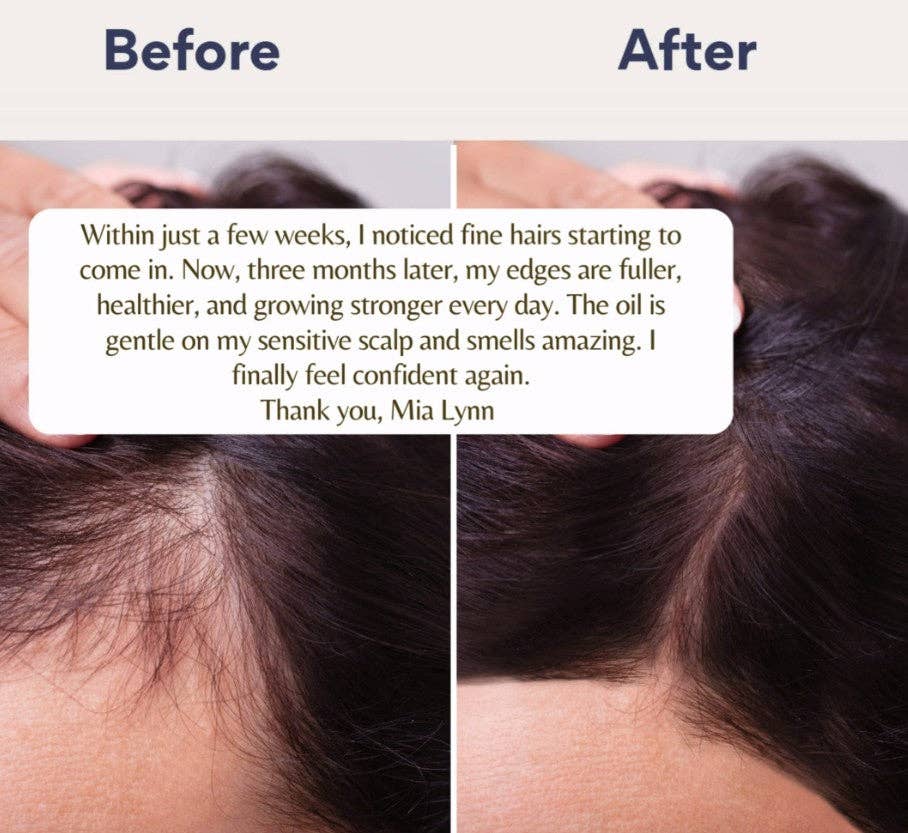 Mia Lynn Naturals – wholesale Hair oil – Ayurvedic Amla Hair Oil, scalp nourishment 9