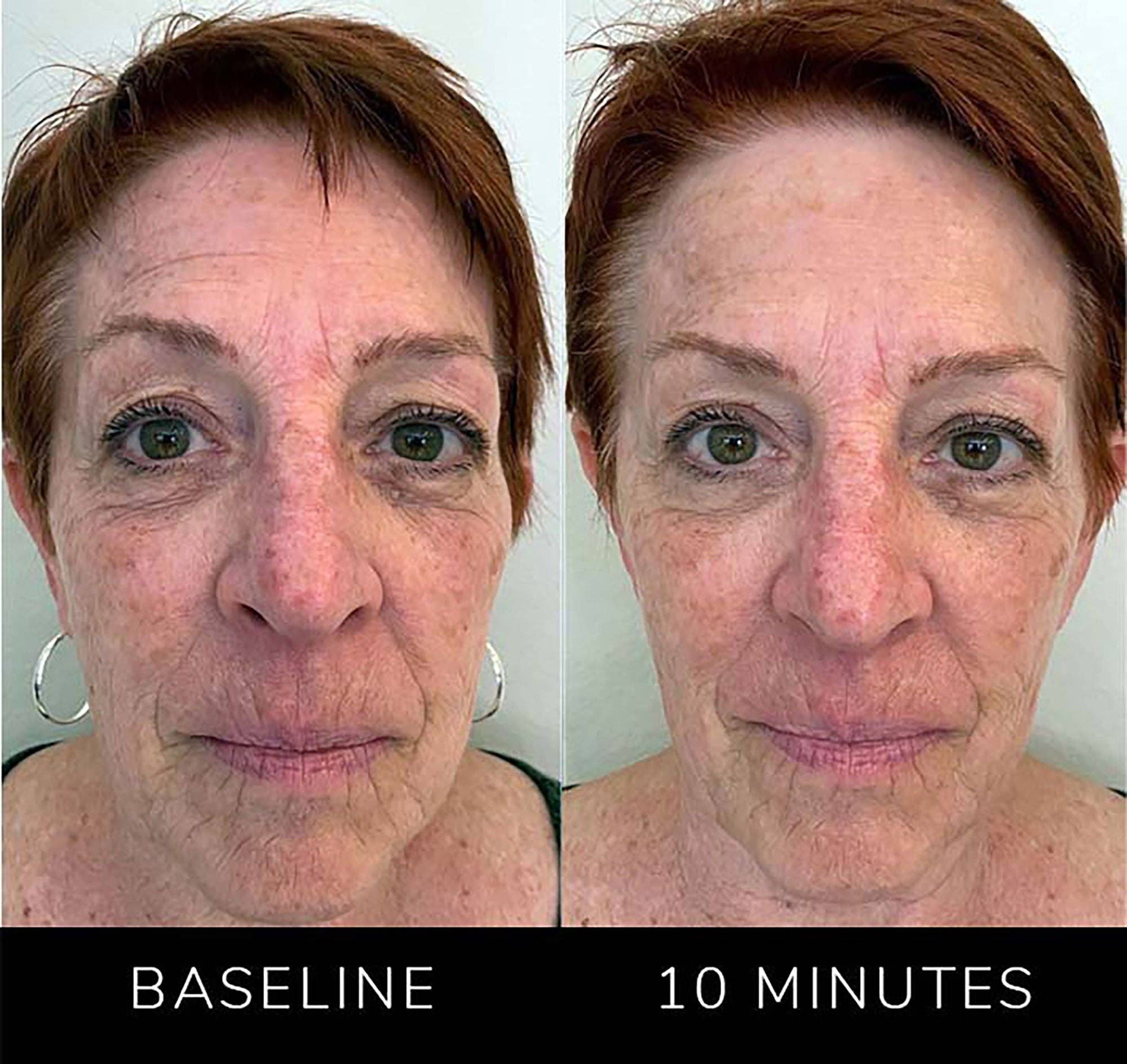 Nature Checkout Inc - Wholesale Electronic Skincare Device - Eno Patented All-In-One Skincare Device. The one device that does it all - exfoliation;  product infusion & facial sculpting11