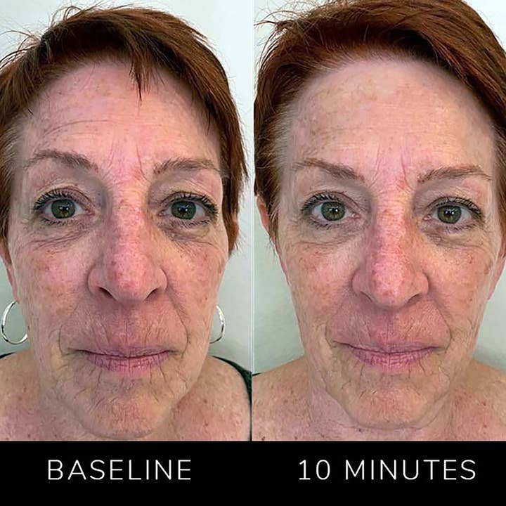 Nature Checkout Inc - Wholesale Electronic Skincare Device - Eno Patented All-In-One Skincare Device. The one device that does it all - exfoliation; product infusion & facial sculpting11