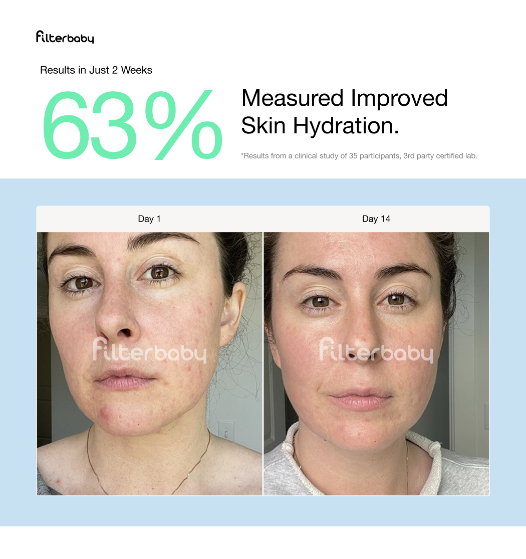 Filterbaby - Vendita all'ingrosso Rulli viso/di bellezza - Filtro per rubinetto Skincare Filterbaby 2.011