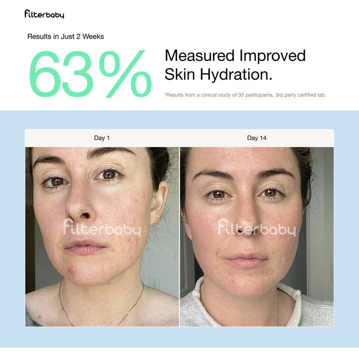 Filterbaby - Wholesale Face/beauty roller - Filterbaby Skincare Faucet Filter 2.0 (6-Month Supply)12