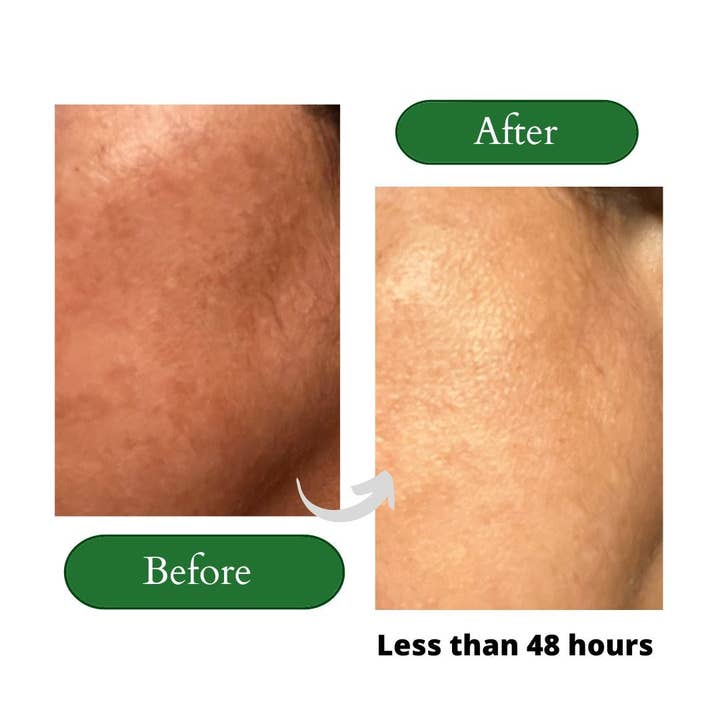 LOHV ESSENTIALS – wholesale Skincare face mask – PREMIUM 100% VEGAN JELLY FACE MASK with Kombucha + Retinol + Turmeric Extract5