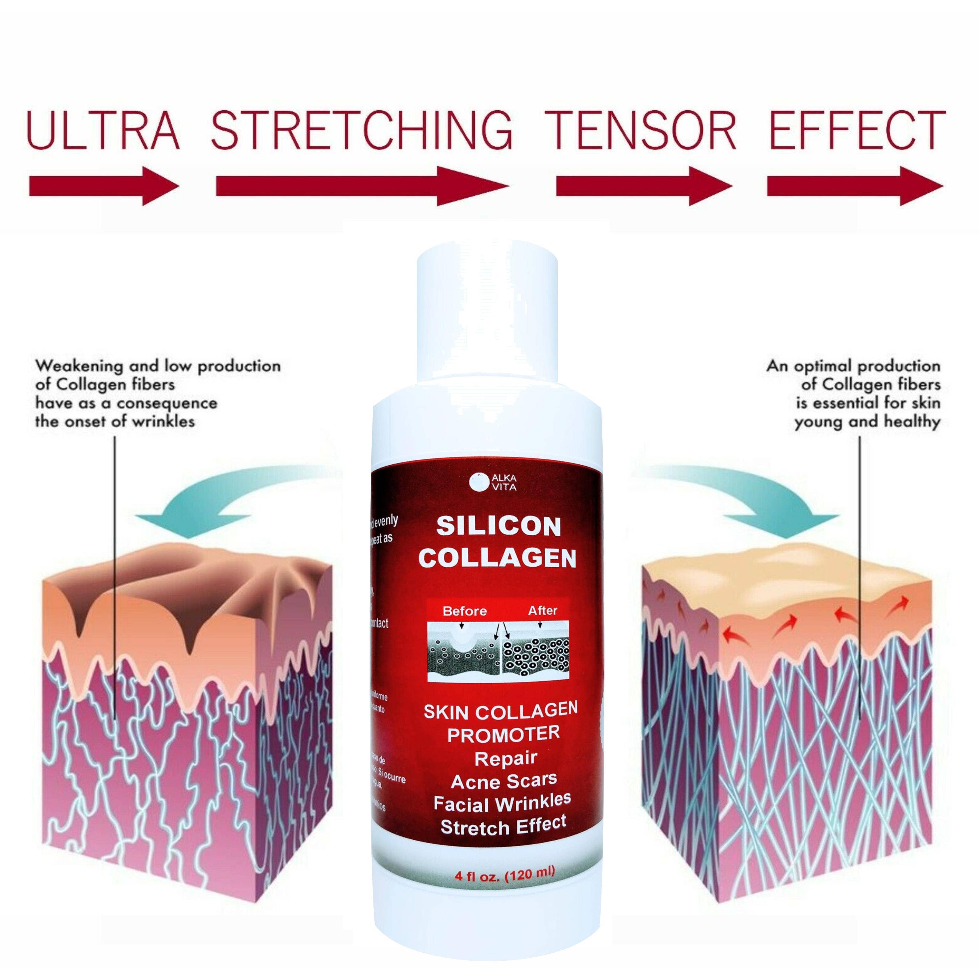 AlkaVita – Adesivo de acne/hidrocolóide por atacado – Cicatrizes de acne Silicon Gel Pele Colágeno Promotor Resurfacing2