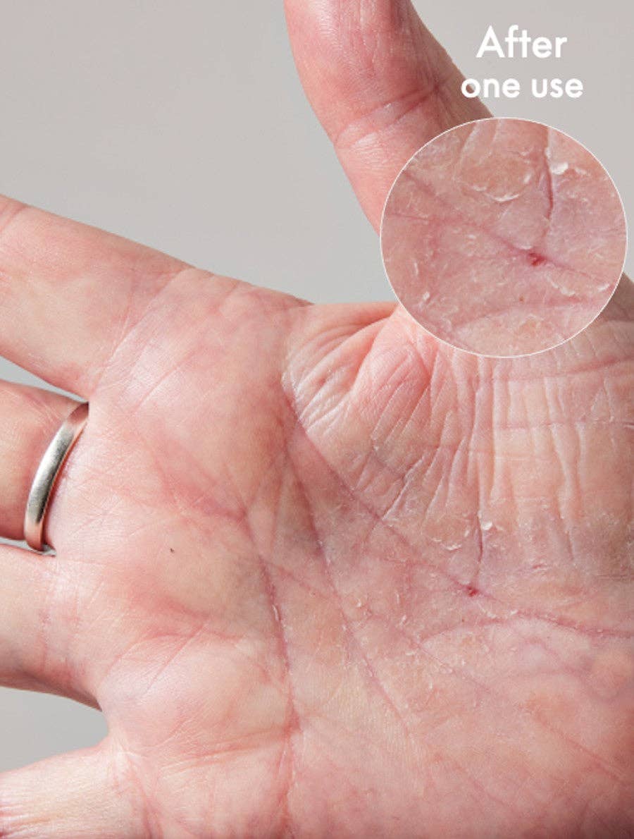 Lanolips - Wholesale Body Cream/Lotion - 101 Dry Skin Super Cream - Multipurpose For Face + Body6