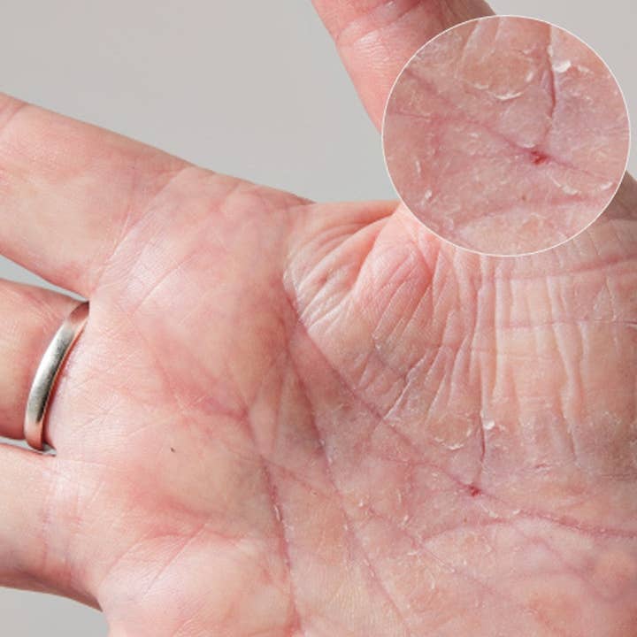 Lanolips - Wholesale Body Cream/Lotion - 101 Dry Skin Super Cream - Multipurpose For Face + Body6