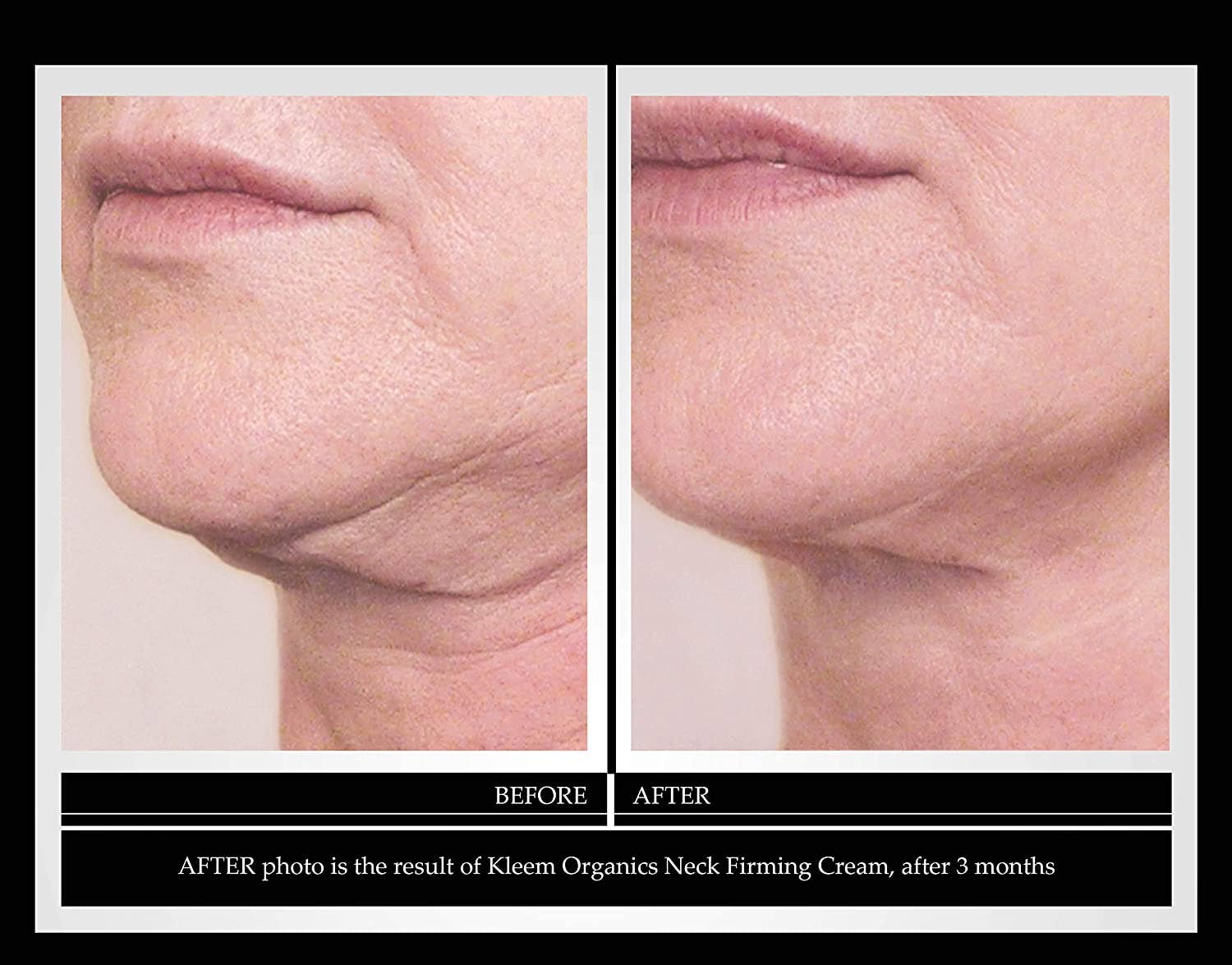 Kleem Organics - Wholesale Anti-Aging Moisturizer - FIRMING NECK CREAM -  For Collagen Stimulation and Lifted Skin5