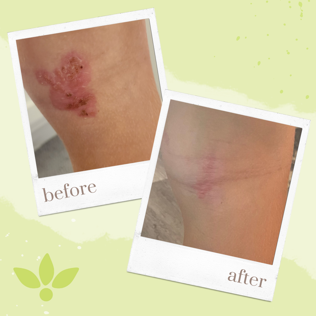 Honeoye Remedies - Wholesale Healing Salve/Balm/Cream - SAVE (MGO 550+) - Skin Balm, 8-pack with PDQ Display (30mL)4