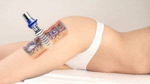 KOWUA HC – wholesale Electronic skincare device – Cavitation 40kHz Online Training2