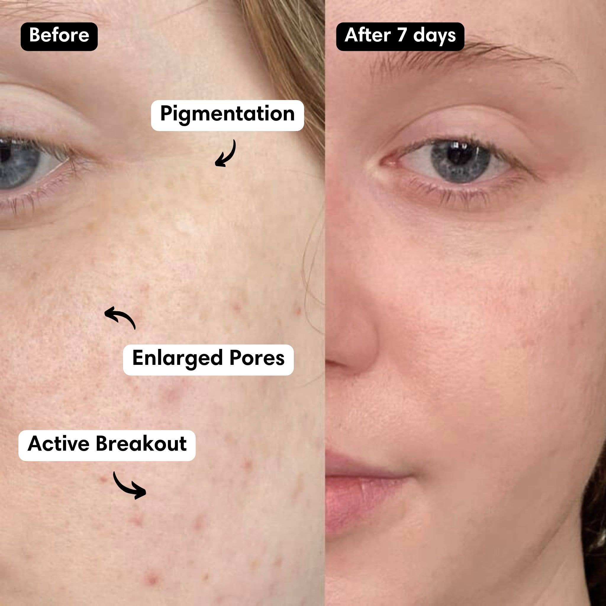 Snow Fox Skincare – Engroshandel Ansigtsmaske – Hot Stone ansigtsmaske2