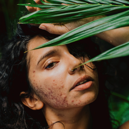 Stay Wild Apothecary - Wholesale Facial Moisturizer - Green Tea & Aloe Organic Face Cream2