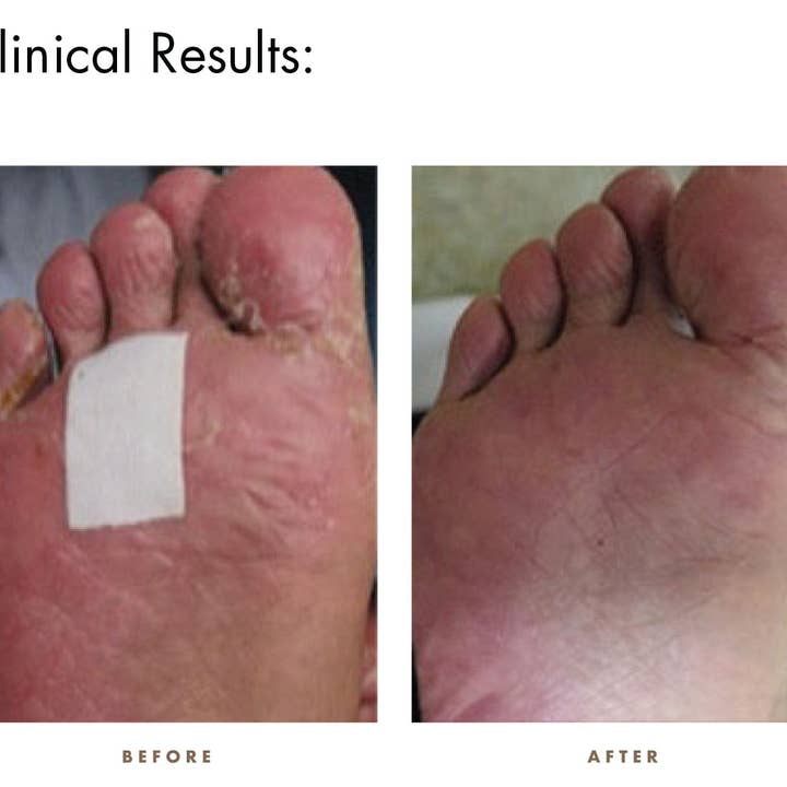 Unitech Medical, the maker of natural CamWell - Wholesale Healing Salve/Balm/Cream - Natural CamWell Hand to Heal for Chemo hands and Foot Care4