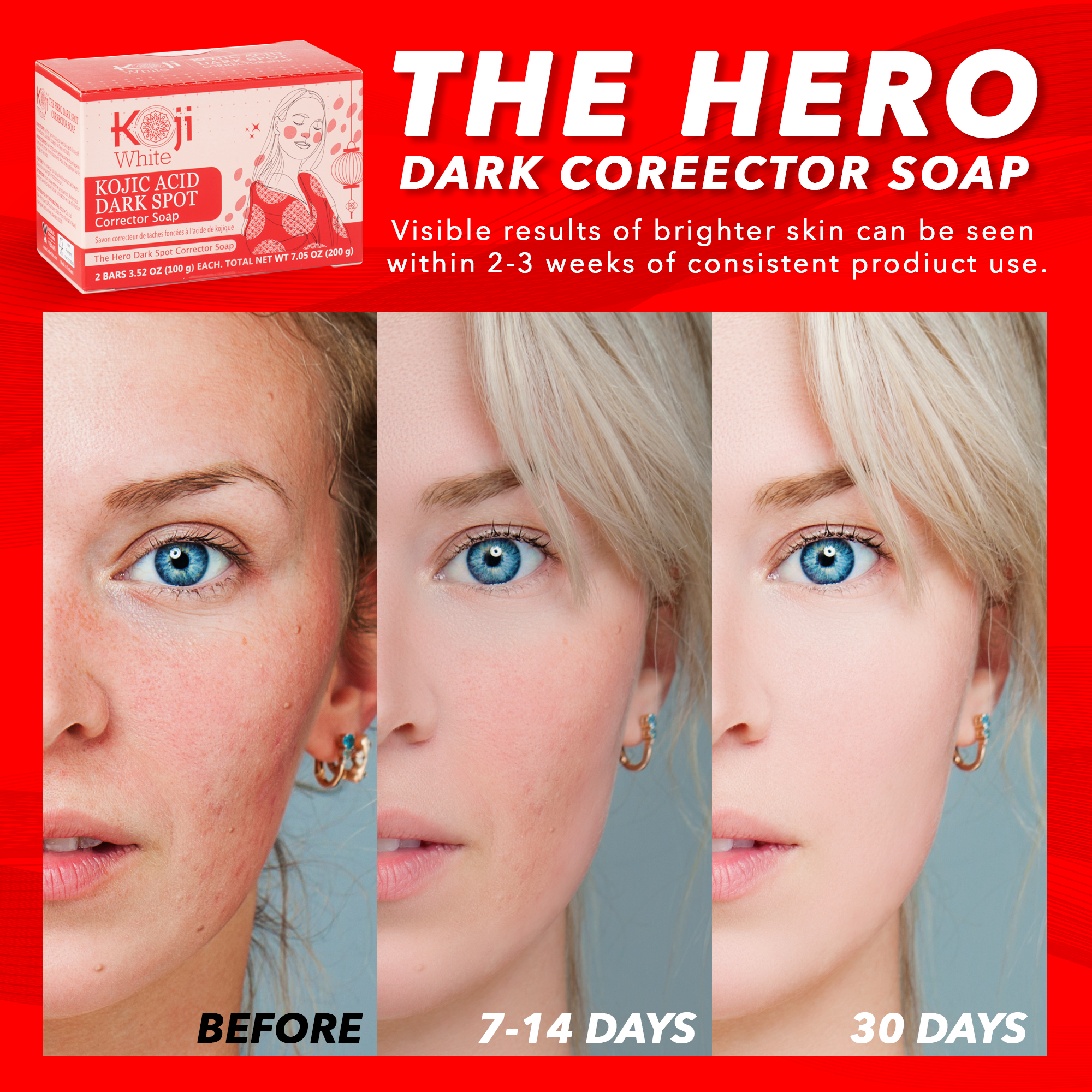 Koji White - Vendita all'ingrosso Detergenti per il viso - Koji White Sapone Correttore per Macchie Scure all'Acido Kojico (2 Saponette)3