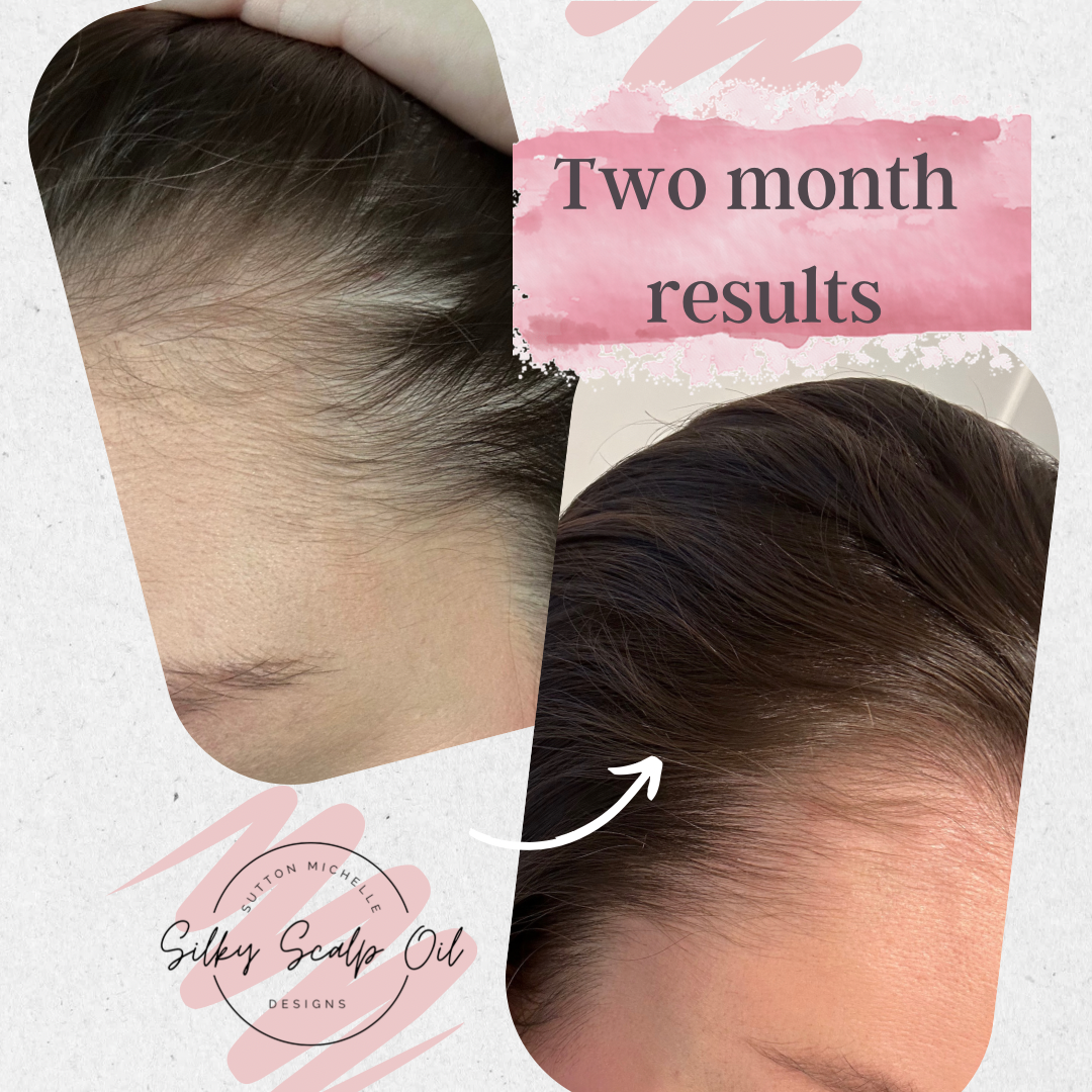 Sutton Michelle Designs - Wholesale Hair Oil - Growth Scalp Oil8