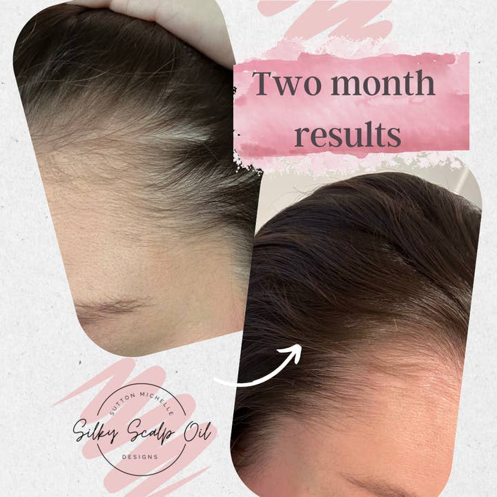 Sutton Michelle Designs - Wholesale Hair Oil - Growth Scalp Oil8