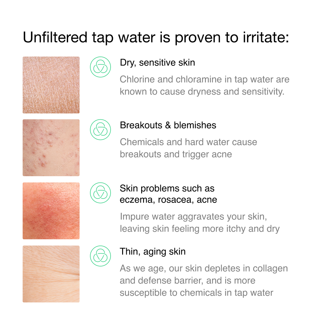 Filterbaby - Vendita all'ingrosso Rulli viso/di bellezza - Filtro per rubinetto Skincare Filterbaby 2.012