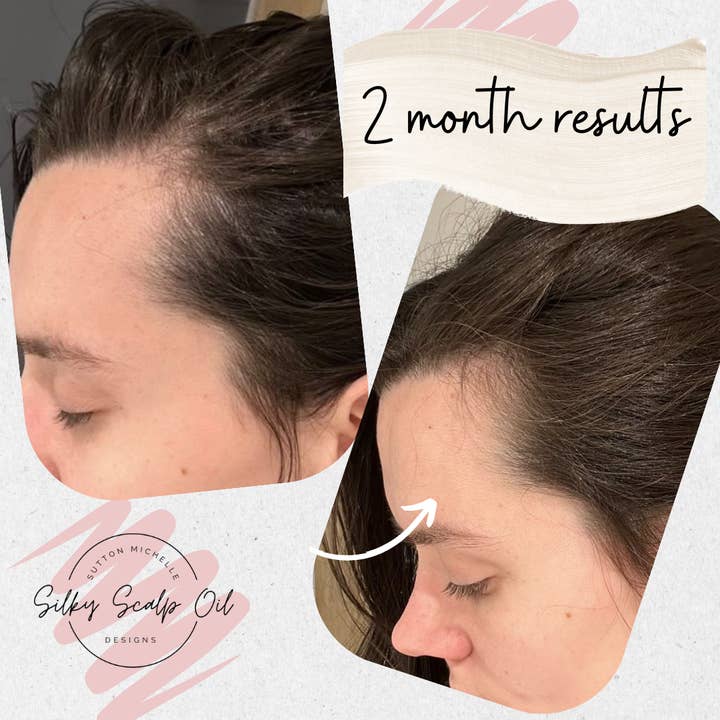 Sutton Michelle Designs - Wholesale Hair Oil - Growth Scalp Oil9