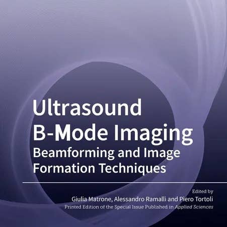 Books by splitShops - Wholesale Medical Health - Ultrasound B-Mode Imaging: Beamforming and Image Formation Techniques - Paperback