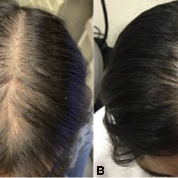 Organic Hair Solution – wholesale Hårolja – CHEBE hårväxt tjockare bunt -2in 1-olja och hårmask-hårförtjockning- pilbarkolja- ricinolja- mangosmör-teträd-pilbark