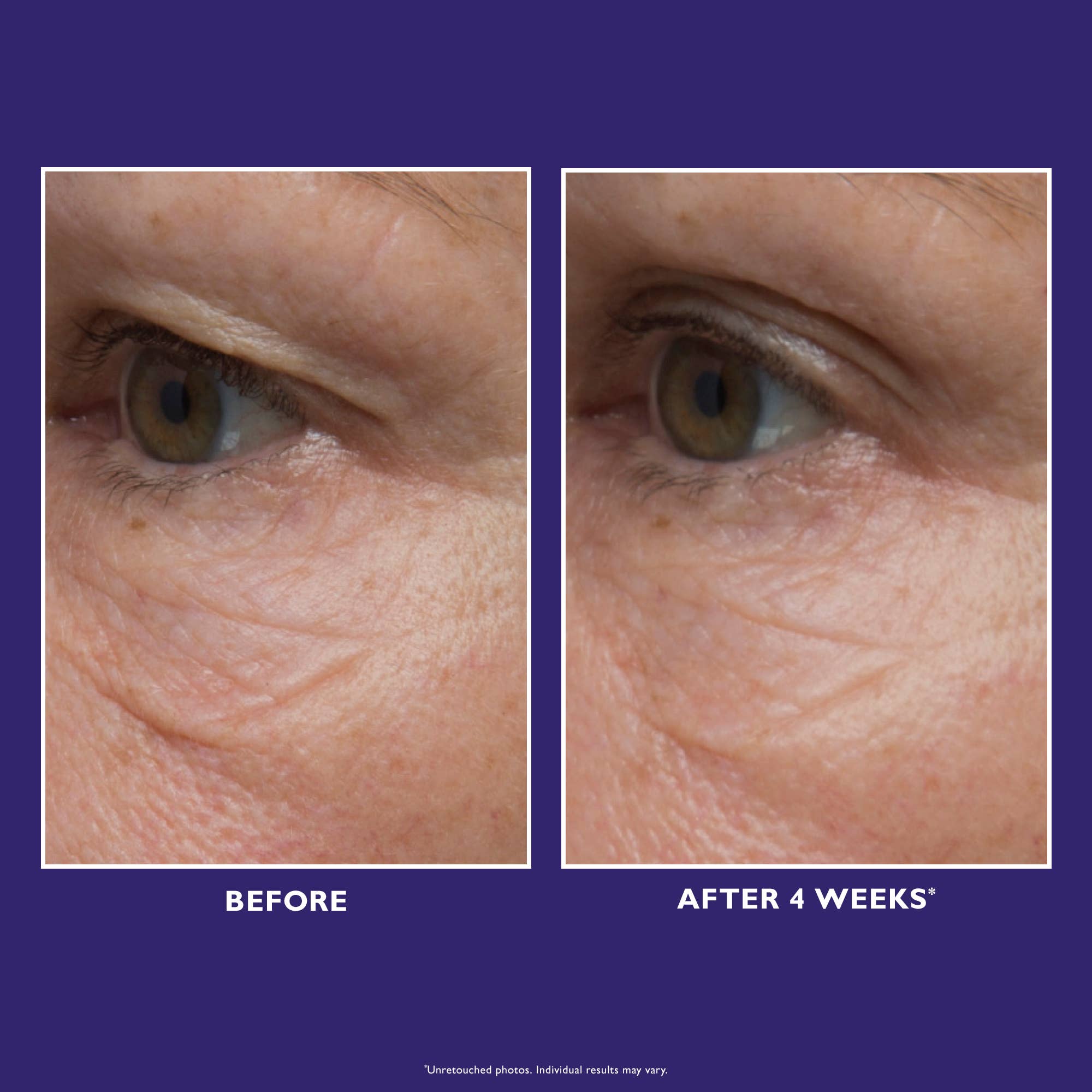 MDV Shop – Großhandel Augencreme/-gel – Peter Thomas Roth - Ultimate Solution 5 Augencreme 15ml4