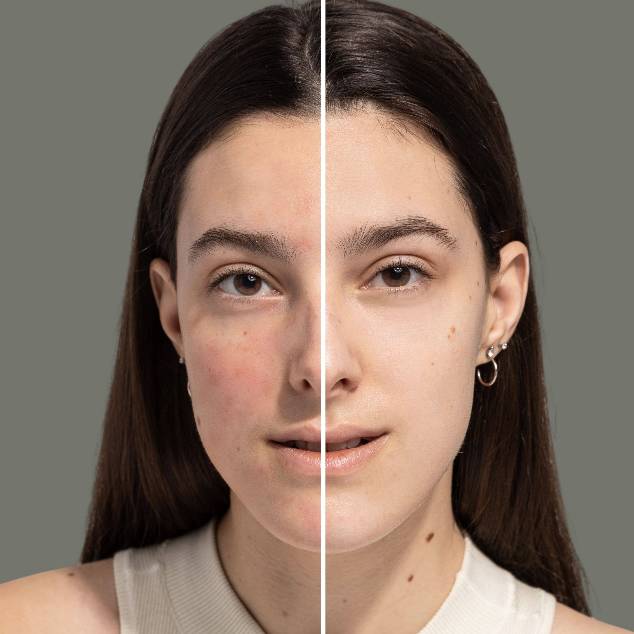 Fitglow Beauty - Wholesale Facial Moisturizer - Redness Rescue Cream (RRC), 30ml1