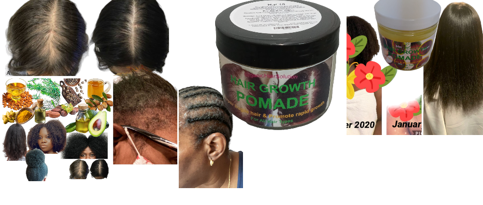 Organic Hair Solution – wholesale Hair pomade – Men's – Hair Growth Pomade Grease with Mango butter, Peppermint Oil, Tea Tree Oil, Argan oil, Jojoba seed, Avocado oil, Castor oil, Sweet Almond, Vitamin E Oil for Scalp and Hair2