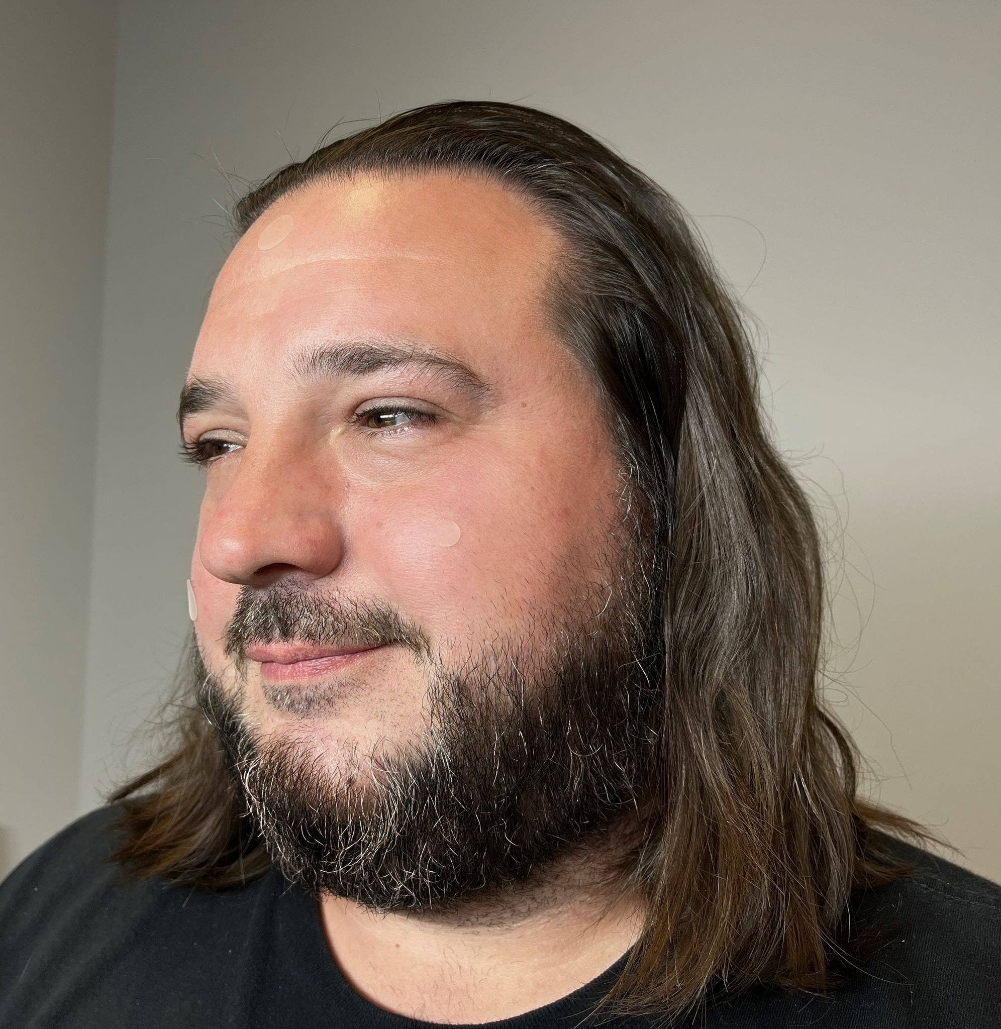 PatchAid - Wholesale Acne/hydrocolloid patch - Pimple Patch - Advanced Acne Relief & Clear Skin5