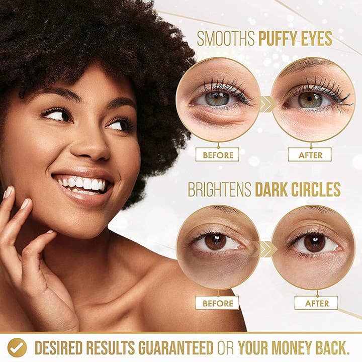 Above Edge - Wholesale Face/Beauty Roller - 24K Gold Eye Mask Puffy Eyes & Dark Circles Treatments 20Pai