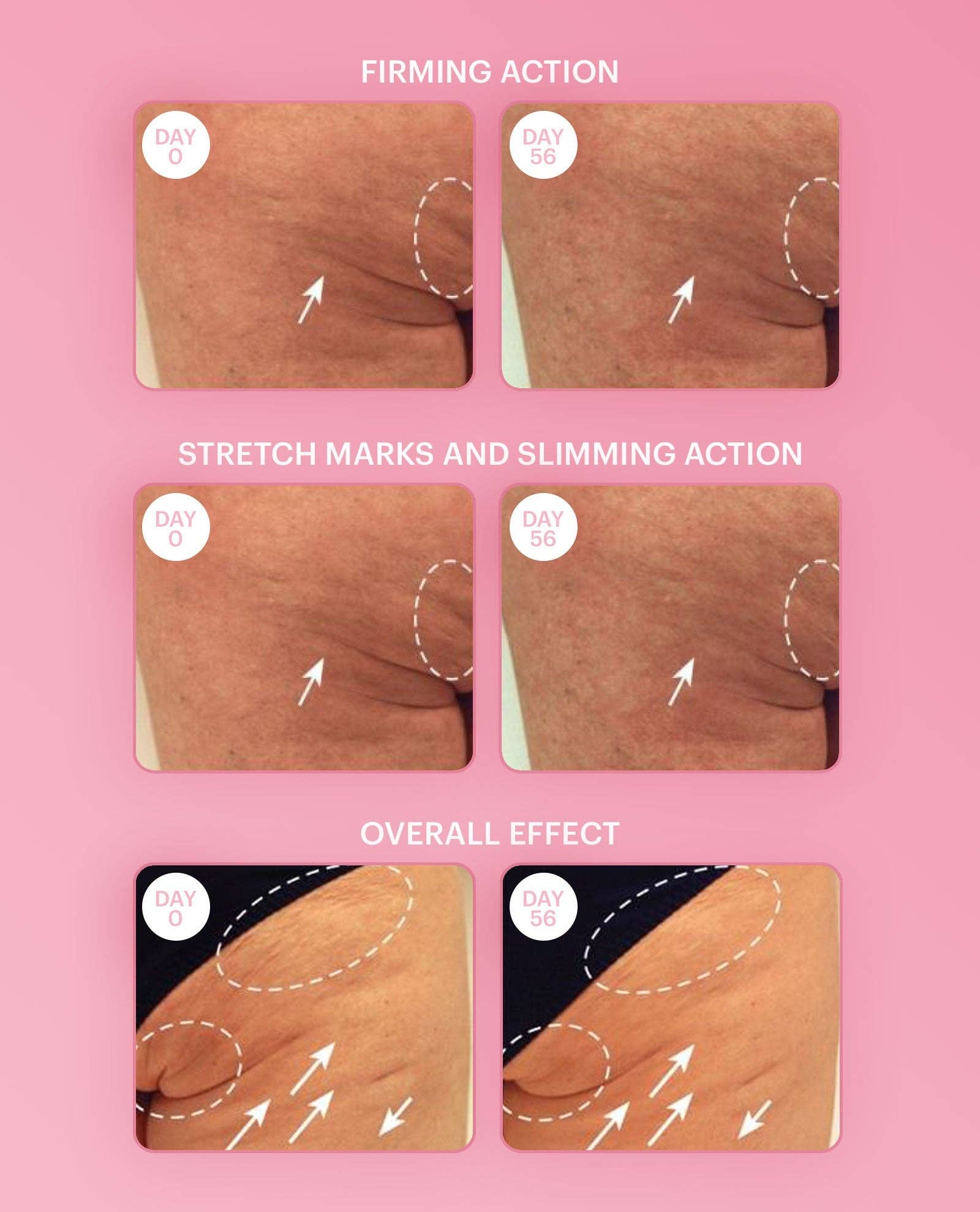 Booby Tape – wholesale Lotioner och fuktkrämer – Firming Breast Lotion6