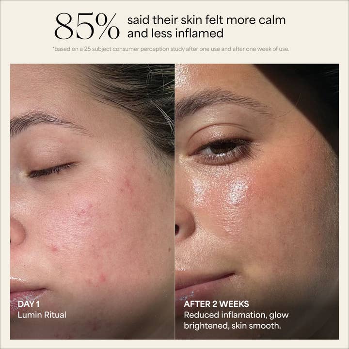 Wildling - Wholesale Body Cupping-set - Lumin cupping set voor gezicht en hals2