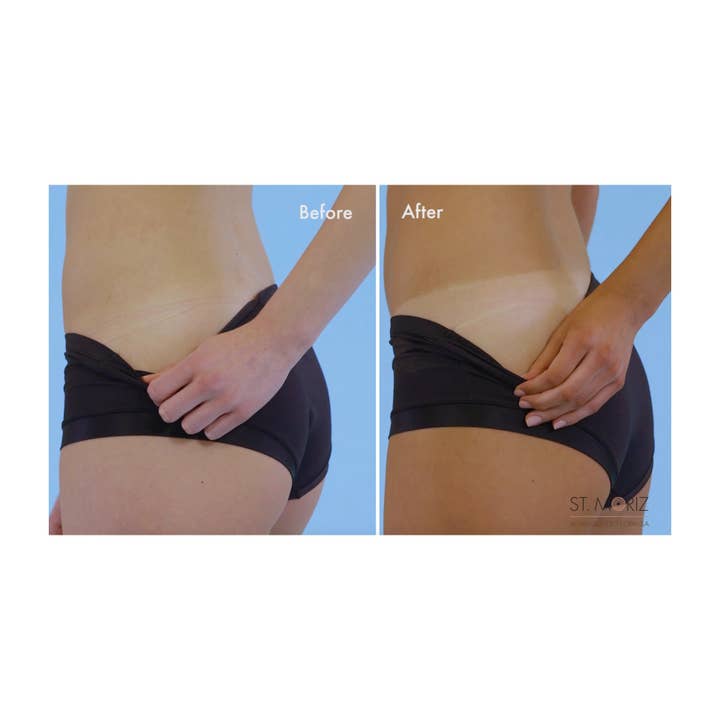 BLIII Holding - Wholesale Self-Tanner - St. Moriz Professional Self-Tanning Lotion Dark1