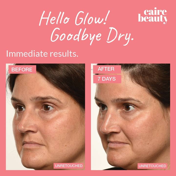 Caire Beauty - Wholesale Facial Serum/Concentrate - Theorem Serum Boost9