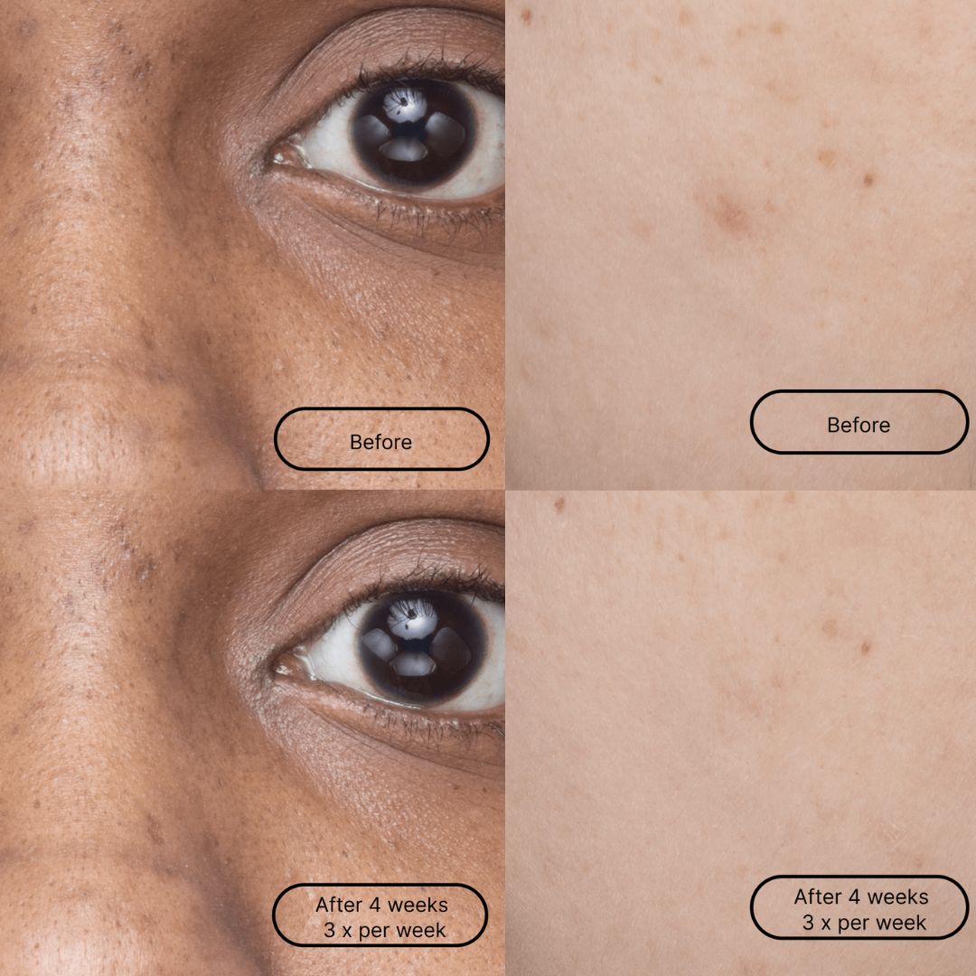 LOOPS - Wholesale Skincare Face Mask - Hyper Smooth Single Mask4