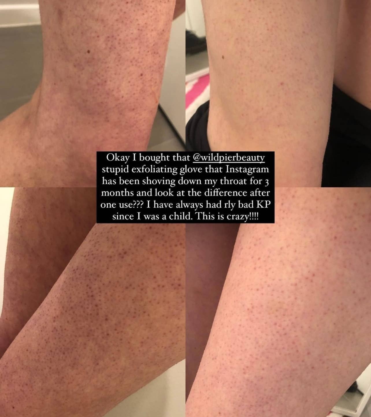 Wildpier Beauty - Vendita all'ingrosso Guanti/muffole esfolianti - Guanto esfoliante profondo Wildpier ™️ Plus+4