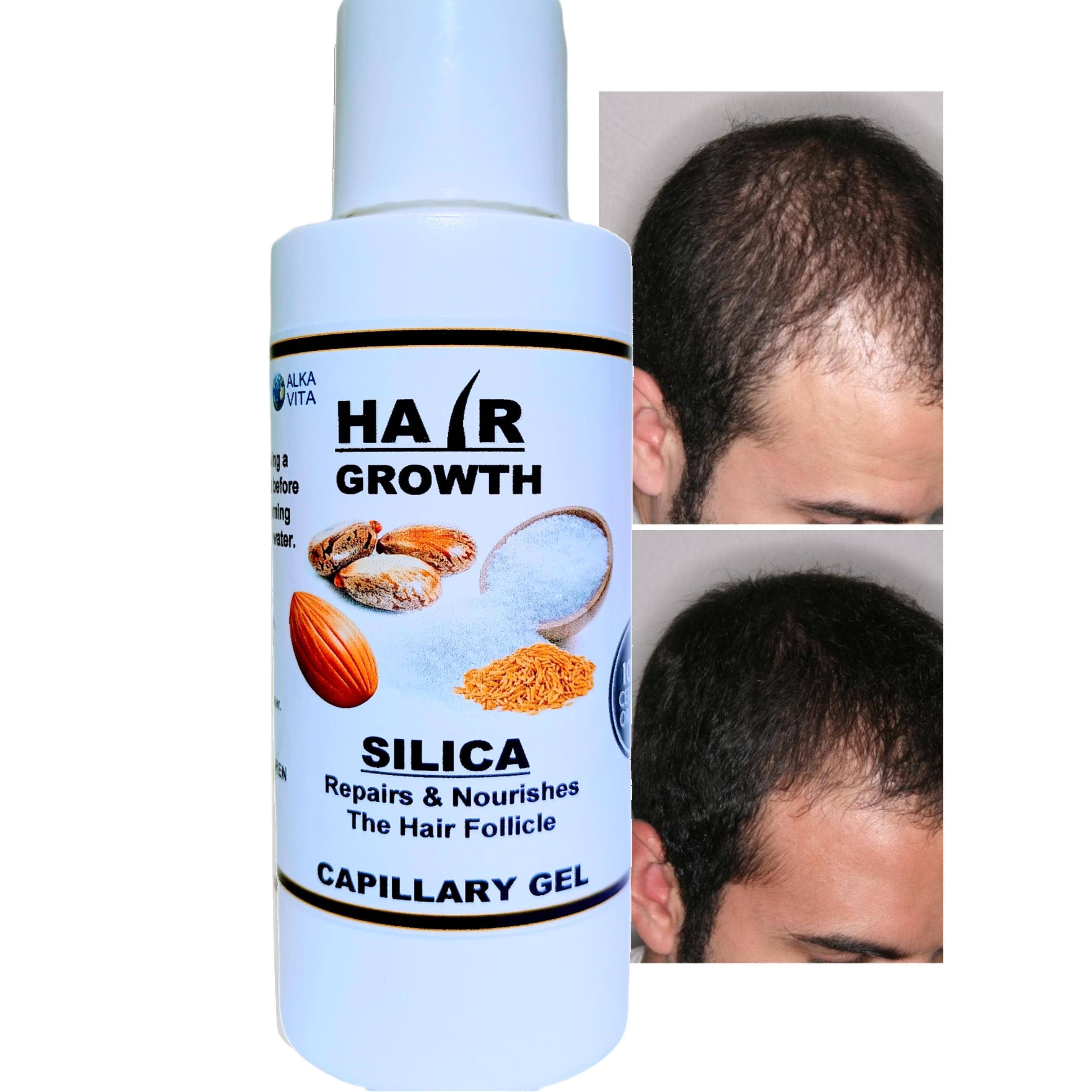 AlkaVita - Wholesale Hair Thinning/Loss Treatment - Hair Loss Growth Gel Silica Cactus Rice Biotin Almond Oil
3