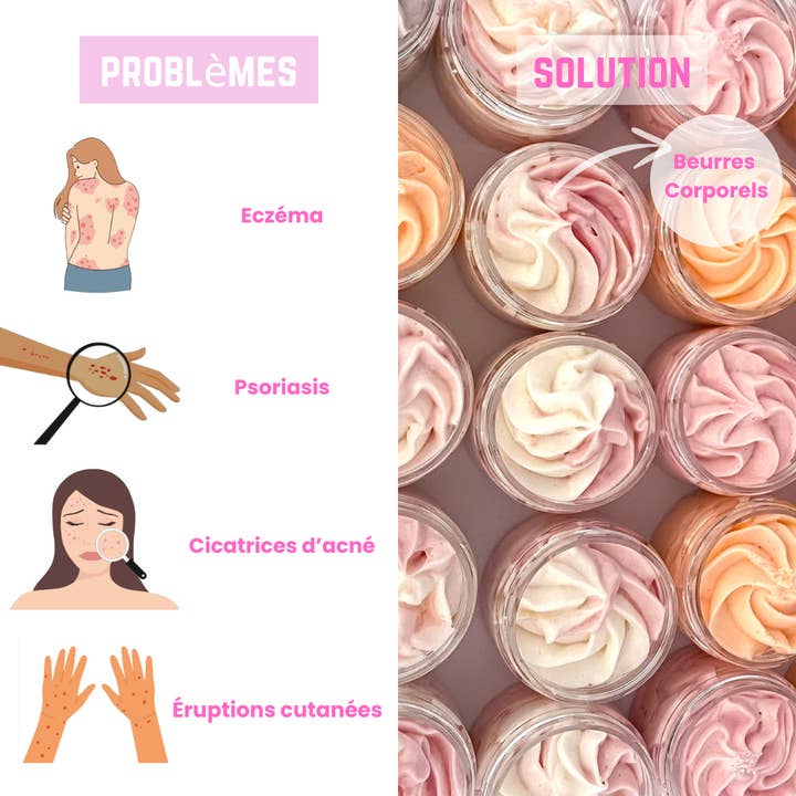 Sorbetbeaute - Wholesale Body Balm/Butter - Whipped body butter/shea whipped whipped cream 50ml3