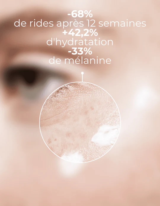 DERMEDEN - Wholesale Eye Cream/Gel - Intense Eye Contour3