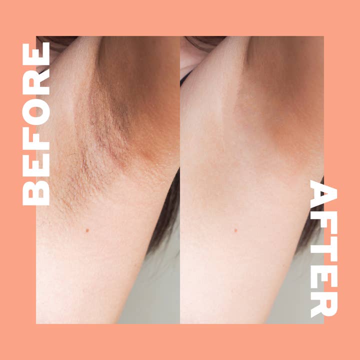 Volition Beauty - Wholesale Deodorant - Women's - Peachy Pits Brightening Underarm Deo-Balm4