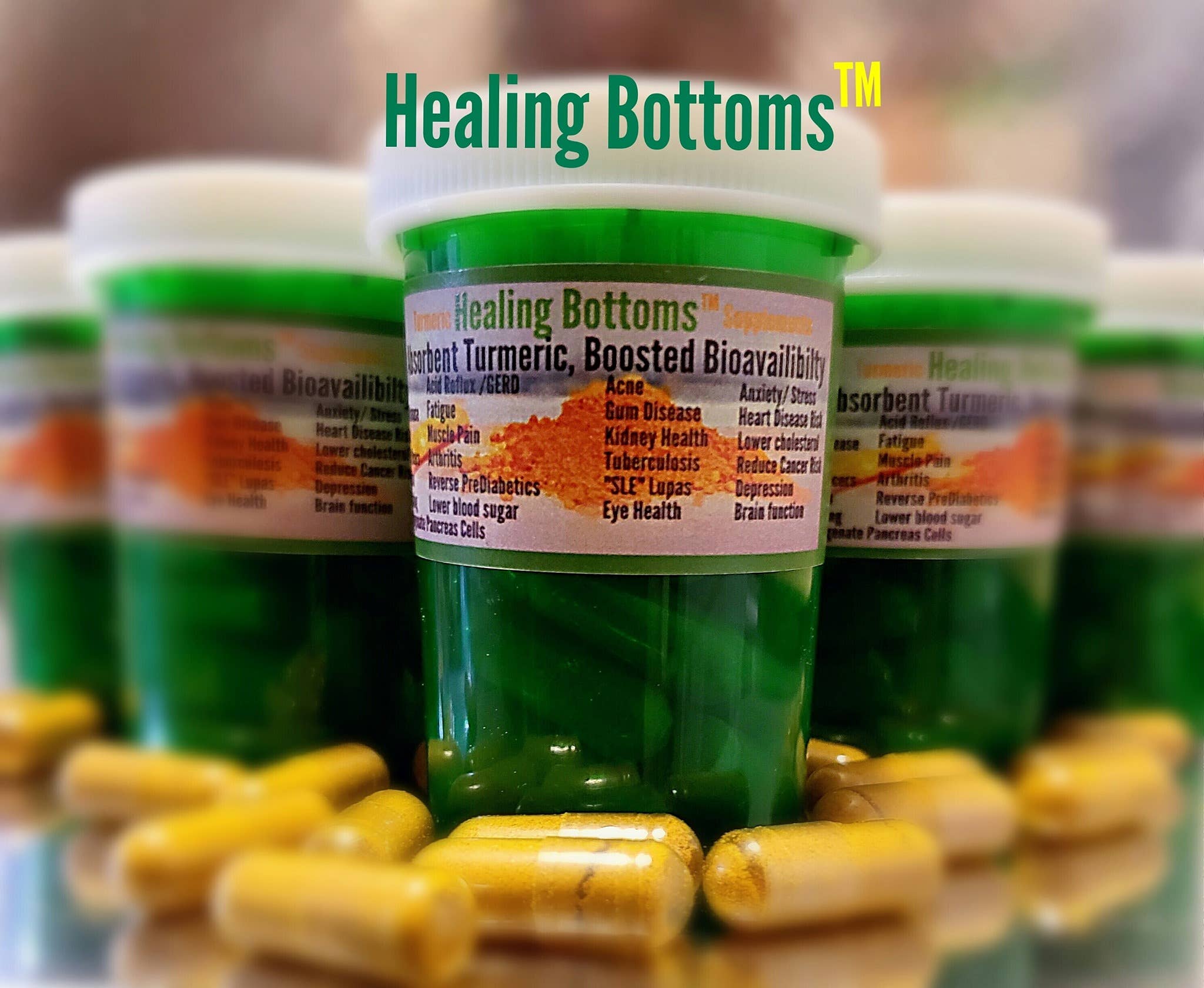 Healing Bottoms – Großhandel Nahrungsergänzungsmittel/Vitamin zum Einnehmen – Max-Kurkuma-Nahrungsergänzungsmittel von HB0