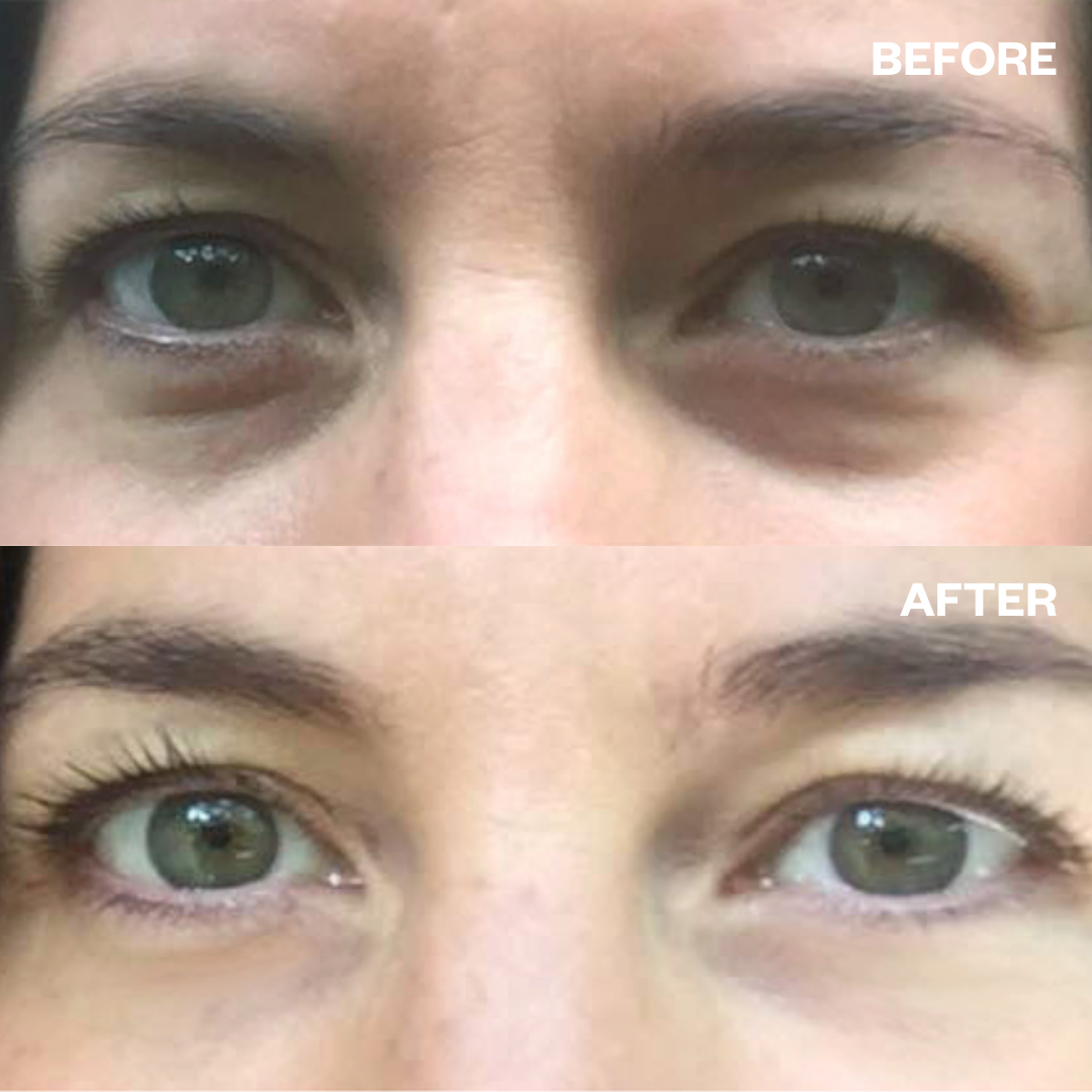 Abundance Naturally Ltd. - Wholesale Eye Treatment Mask - Wrinkles Schminkles | Eye Wrinkle Patches4