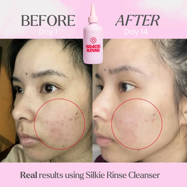 Kiramoon - Wholesale Facial Cleanser - Silkie Rinse Gentle Hydrating Ceramide Cleanser4