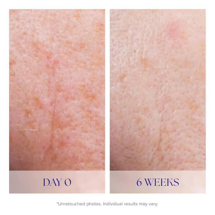 MEHIAZ - Wholesale Facial Serum/Concentrate - iS CLINICAL Active Serum – Anti-Aging & Acne Treatment4