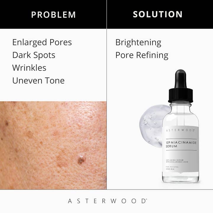 Asterwood - Wholesale Facial Serum/Concentrate - Niacinamide Serum1