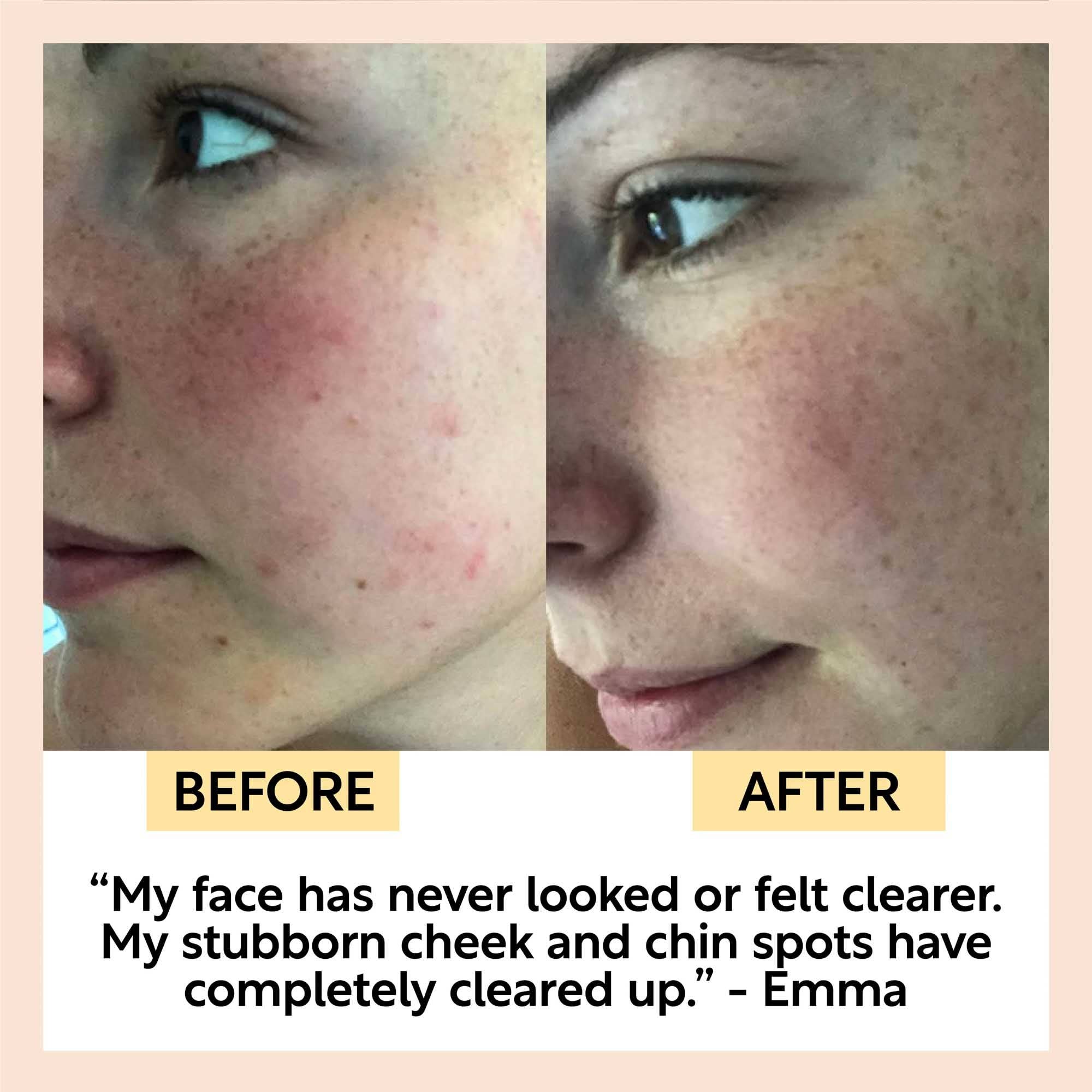 VIAI Beauty – wholesale Bar Soap – UPCIRCLE Chai Soap Cleansing Duo6