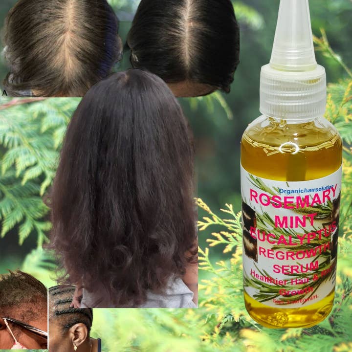 Organic Hair Solution - Wholesale Hair oil - Rosemary Mint Scalp & Hair Strengthening Oil With Biotin & Essential Oils, Nourishing Treatment for Split Ends and Dry Scalp for All Hair Types, 2-Fluid Ounces4