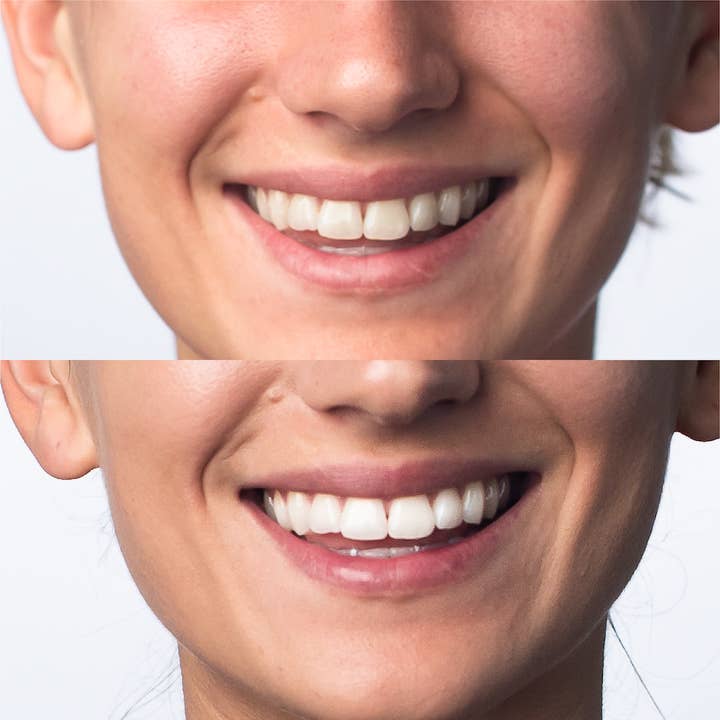 Dr. Brite - Venta al por mayor Blanqueadores dentales - Bolígrafo blanqueador de dientes STAY BRITE™3