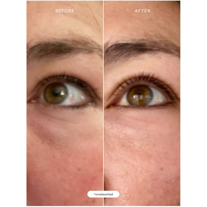 True Botanicals - Wholesale Eye Cream/Gel - Renew Resurrection Radiance Eye Cream