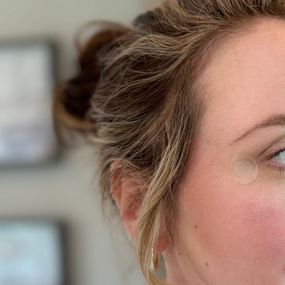 PatchAid – wholesale Skin Smoothing Kit – Blemish & Wrinkle Patch with Microneedle Technology4